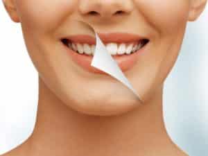 How Not To Kill Your Teeth With Home Whitening|Beauty>Teeth Beauty